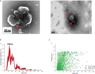 Extracellular vesicles derived from Trichinella Spiralis larvae promote the polarization of macrophages to M2b type and inhibit the activation of fibroblasts